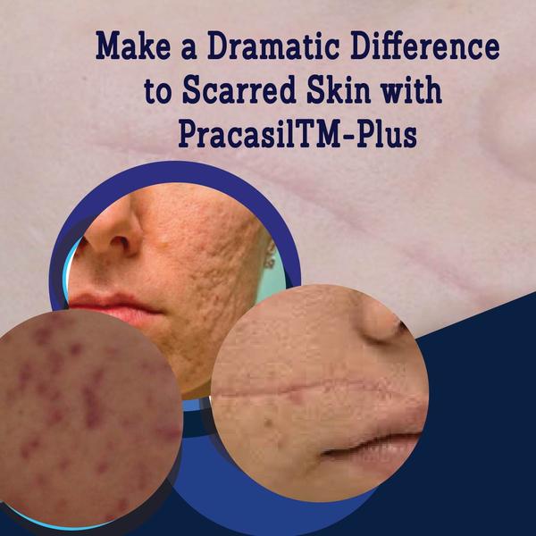 Make a Dramatic Difference to Scarred Skin with Pracasil™-Plus