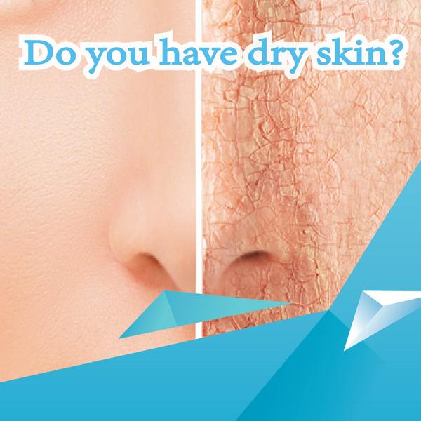 Do you have dry skin?