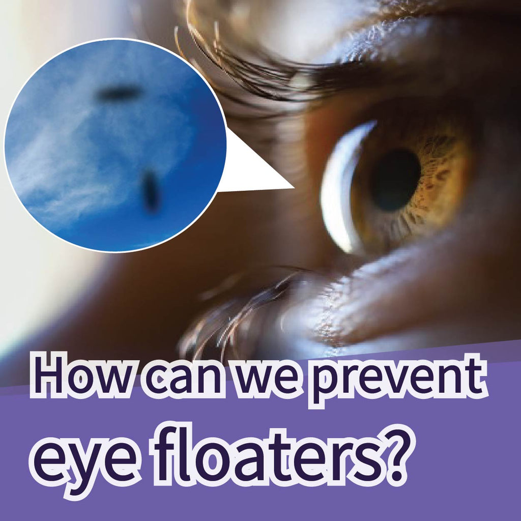 How can we prevent eye floaters?